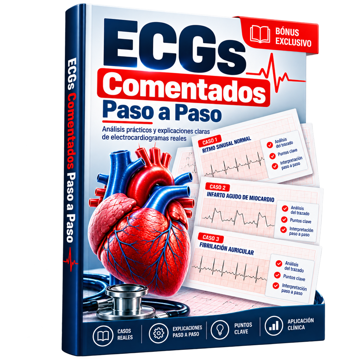 ECGs Comentados Paso a Paso